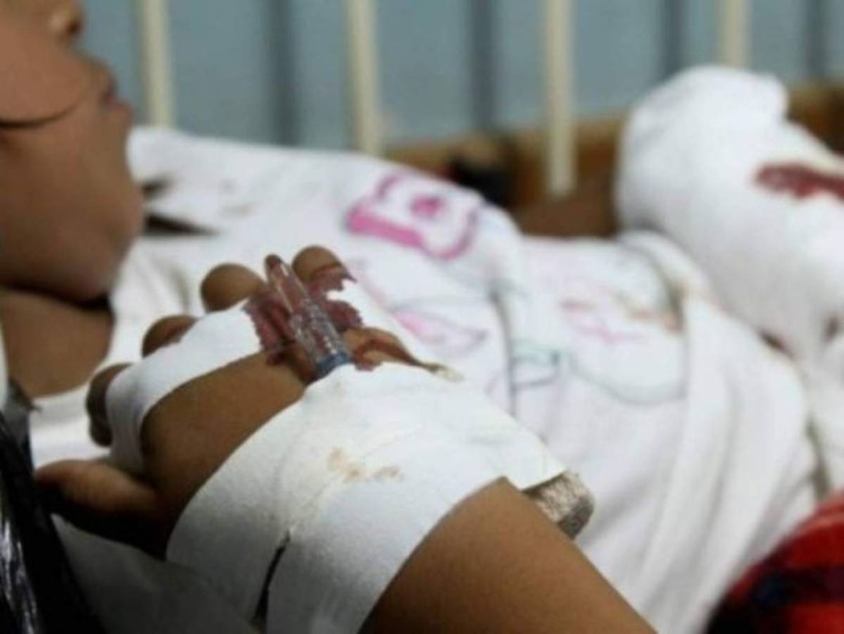 Reportan cinco niños quemados por pólvora en Año Nuevo en la capital