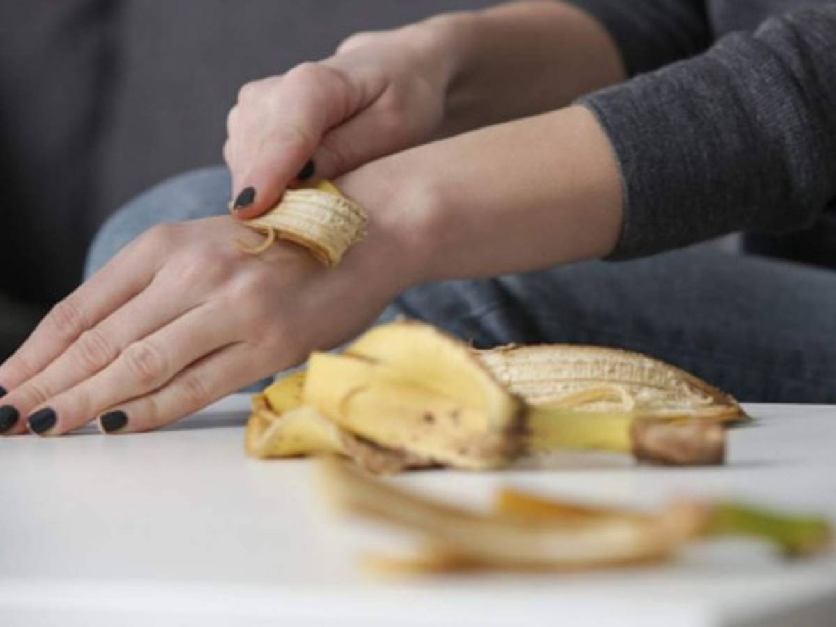 La cáscara de banana puede aliviar el dolor causado por una picadura de insectos. Foto: Pixabay