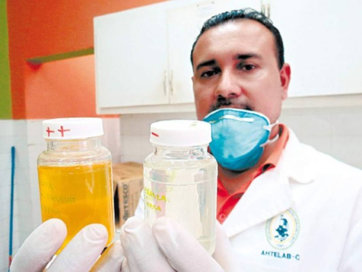 Agua contaminada consumen en aldeas de Comayagua