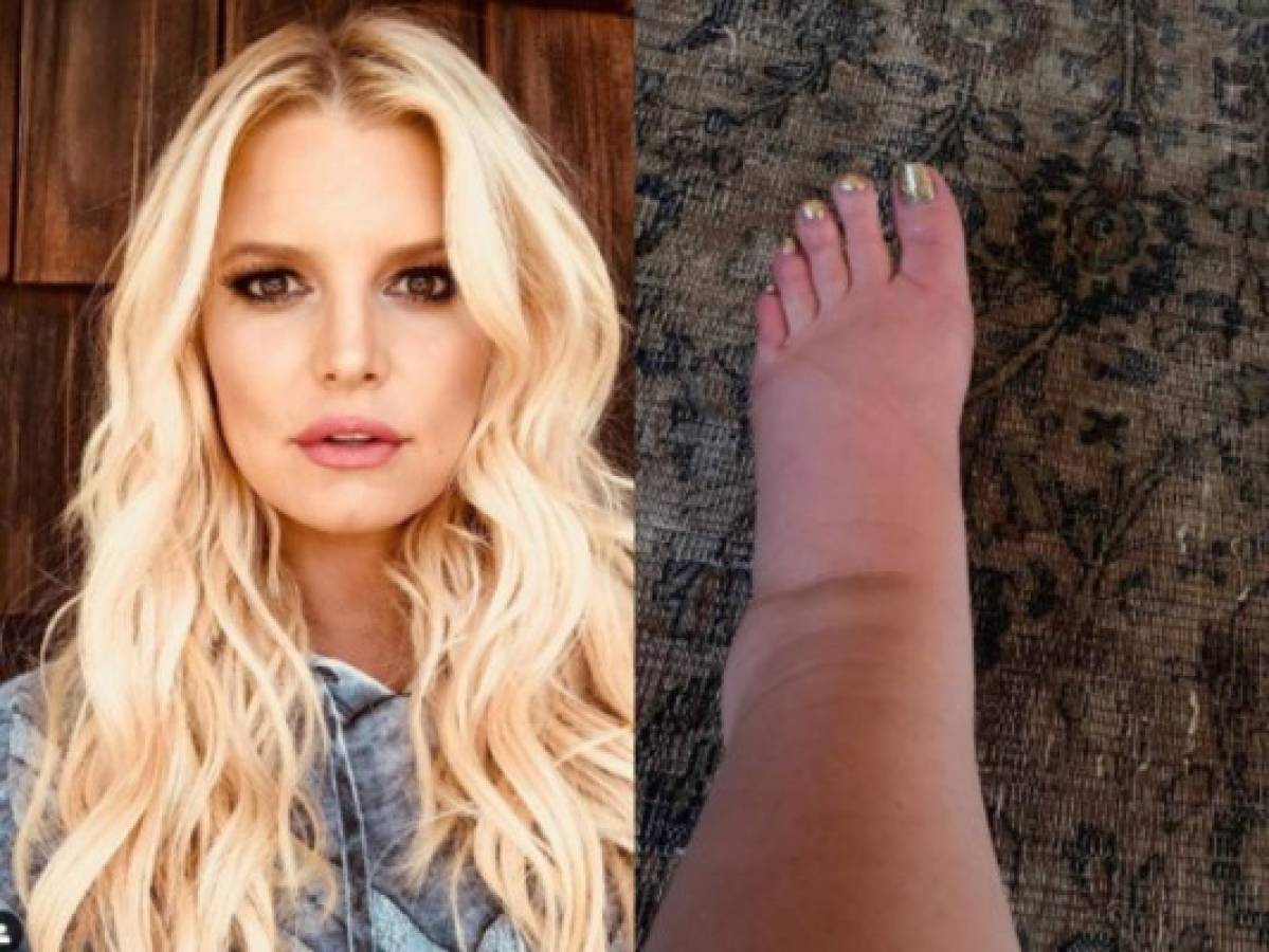 Jessica Simpson muestra los estragos causados por el embarazo