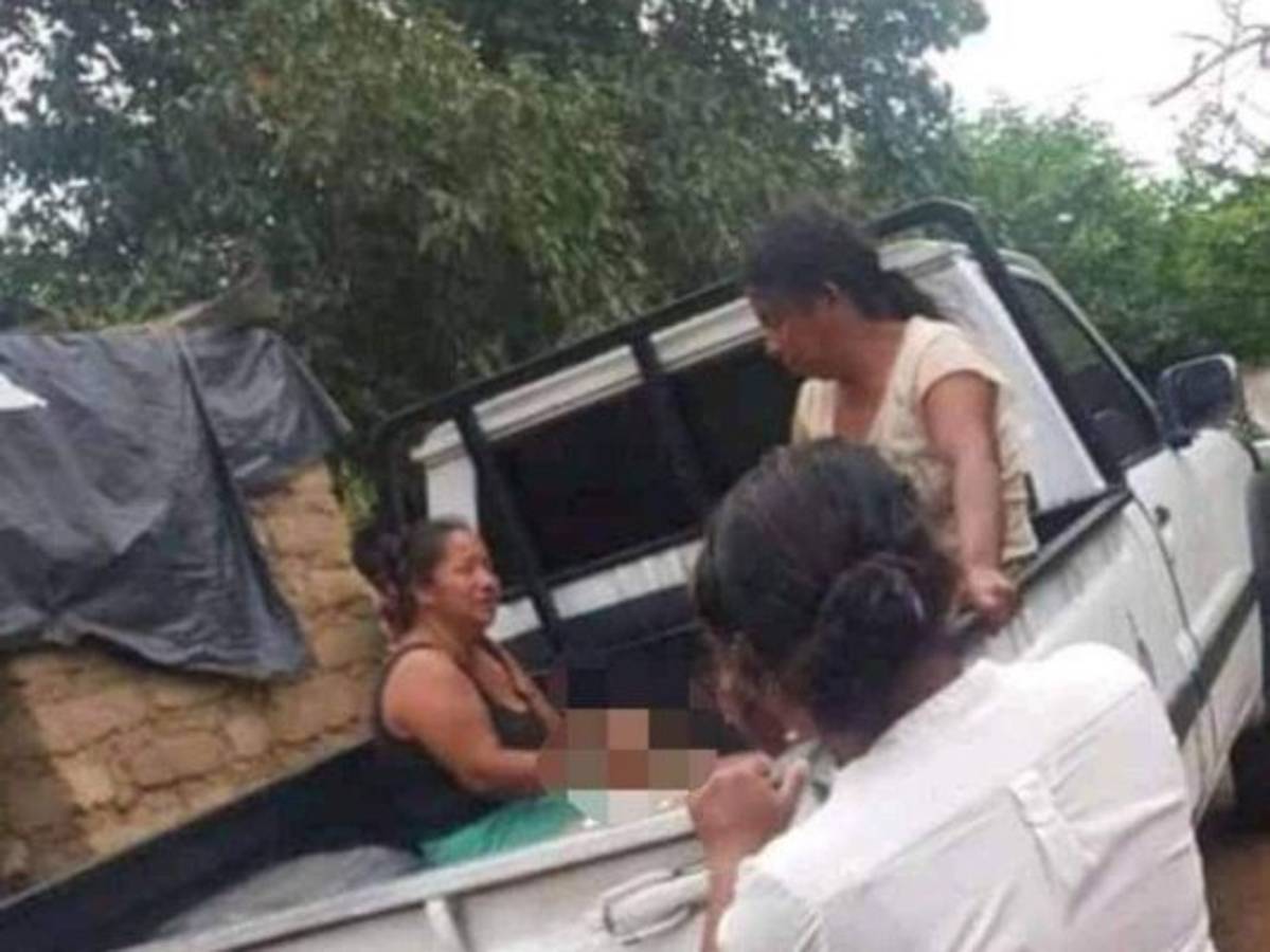 'Solo escuché el bombazo, lo agarré, pero ya estaba muerto”