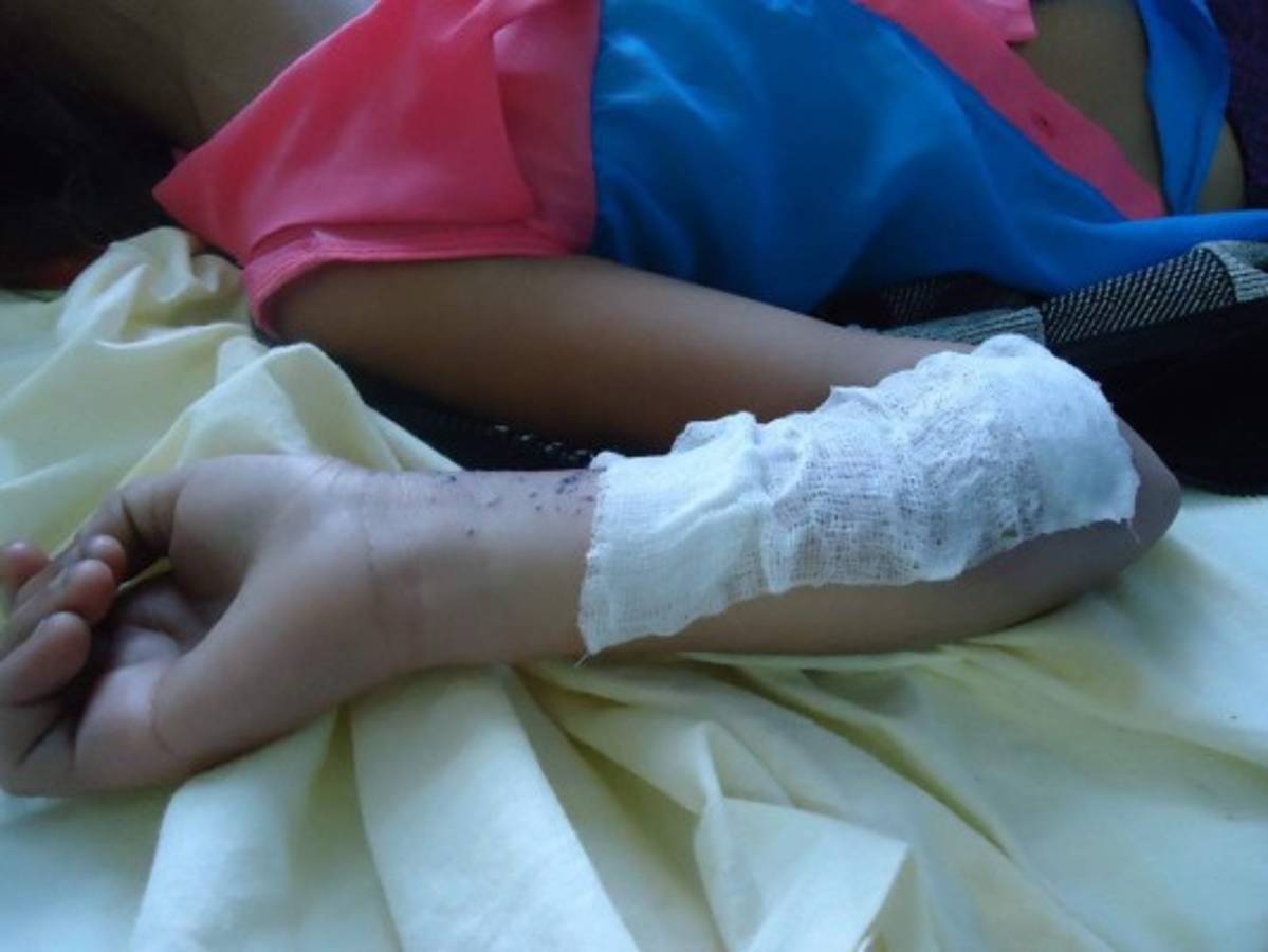 Niña sufre graves quemaduras al caer en agua hirviendo