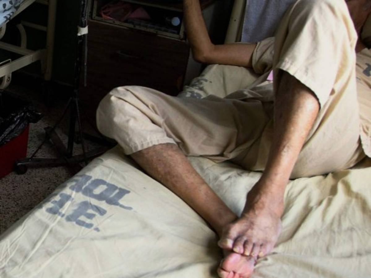 ¿Cuáles son los síntomas del cáncer de pene?