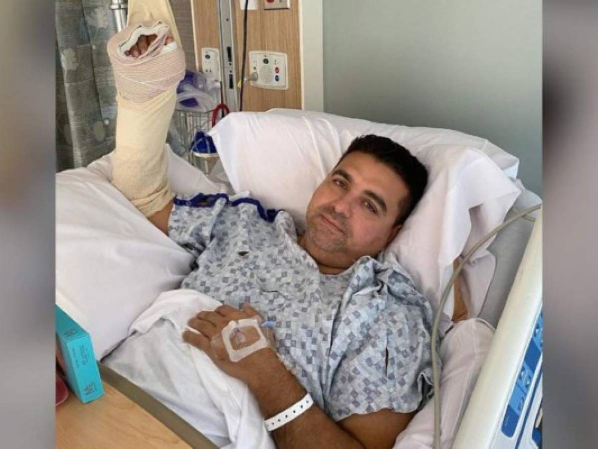 Buddy Valastro tras accidente: 'La varilla estaba atravesando mi mano'