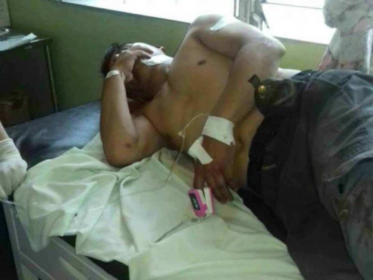 Un muerto y dos heridos dejó enfrentamiento entre vendedores y policías municipales en Comayagua