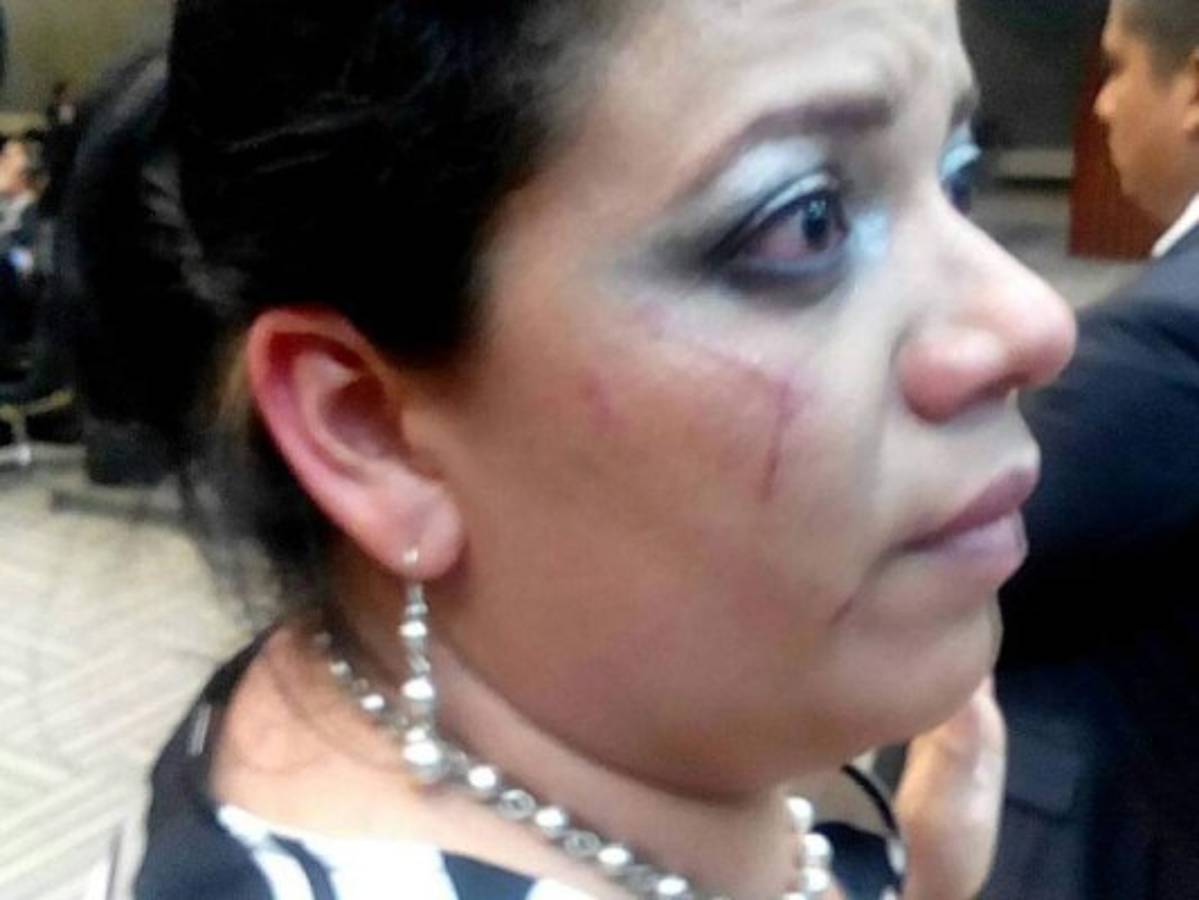 Diputada denuncia agresión de la esposa de David Romero