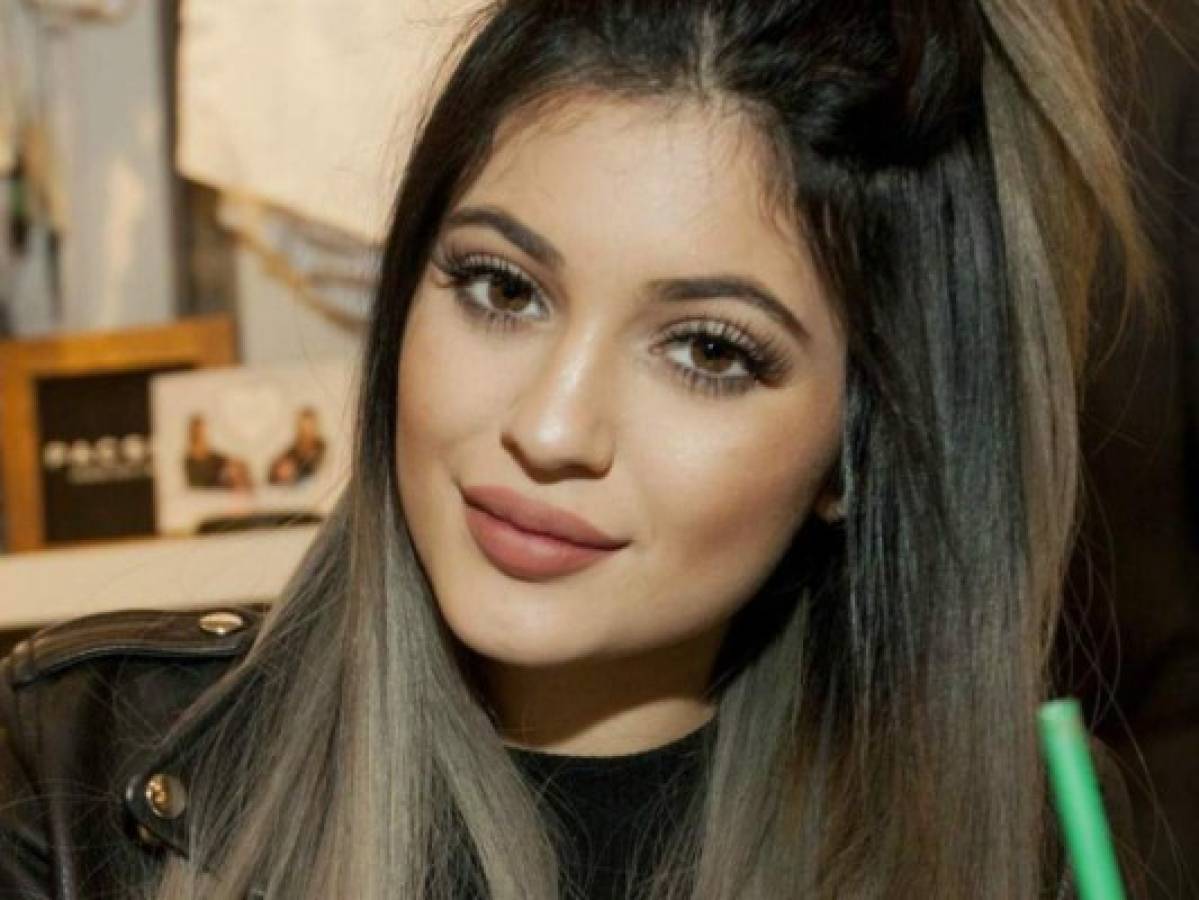 Kylie Jenner no podrá rellenarse los labios durante su embarazo