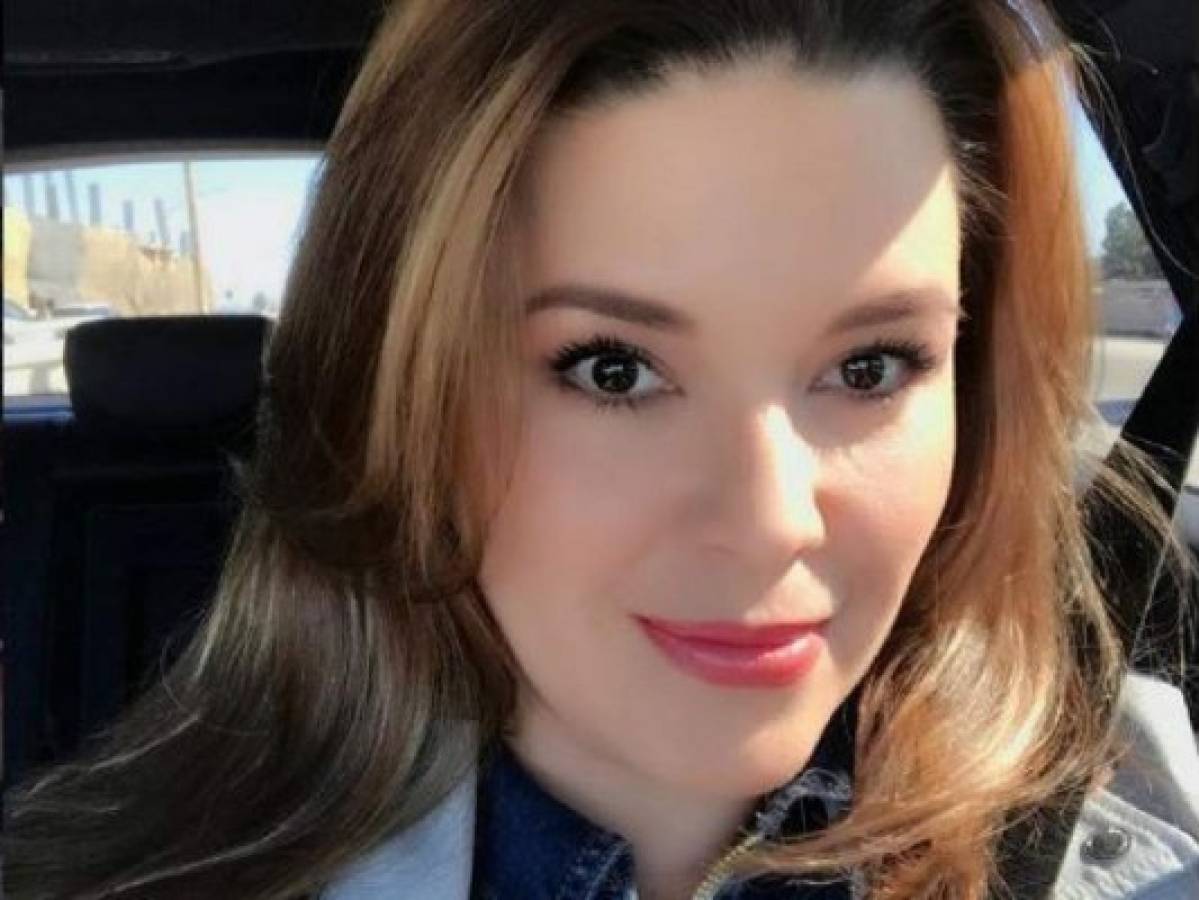 Alicia Machado muestra sus pechos luego de someterse a una cirugía