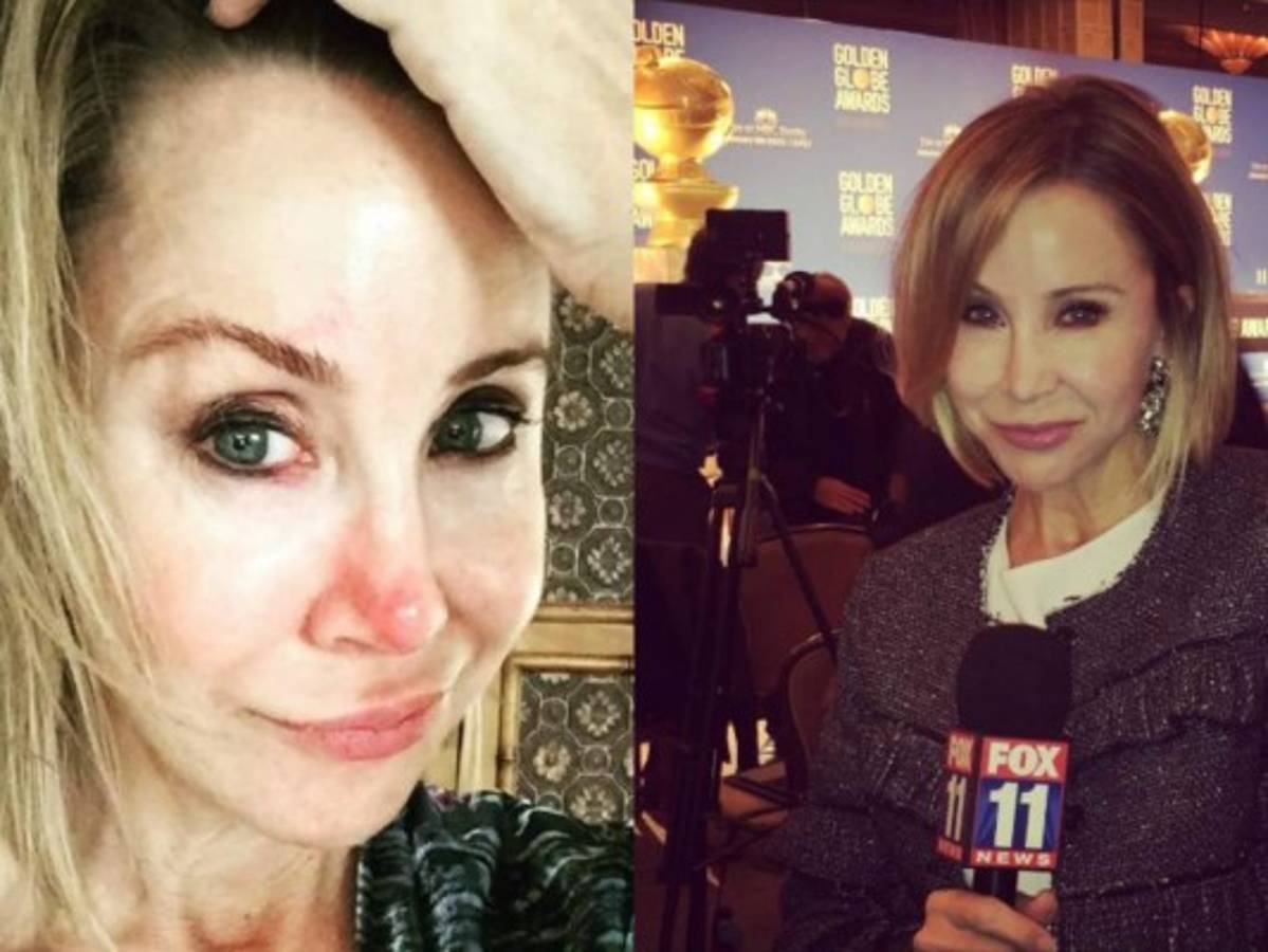 Presentadora de televisión sufre una aparatosa caída en pleno programa