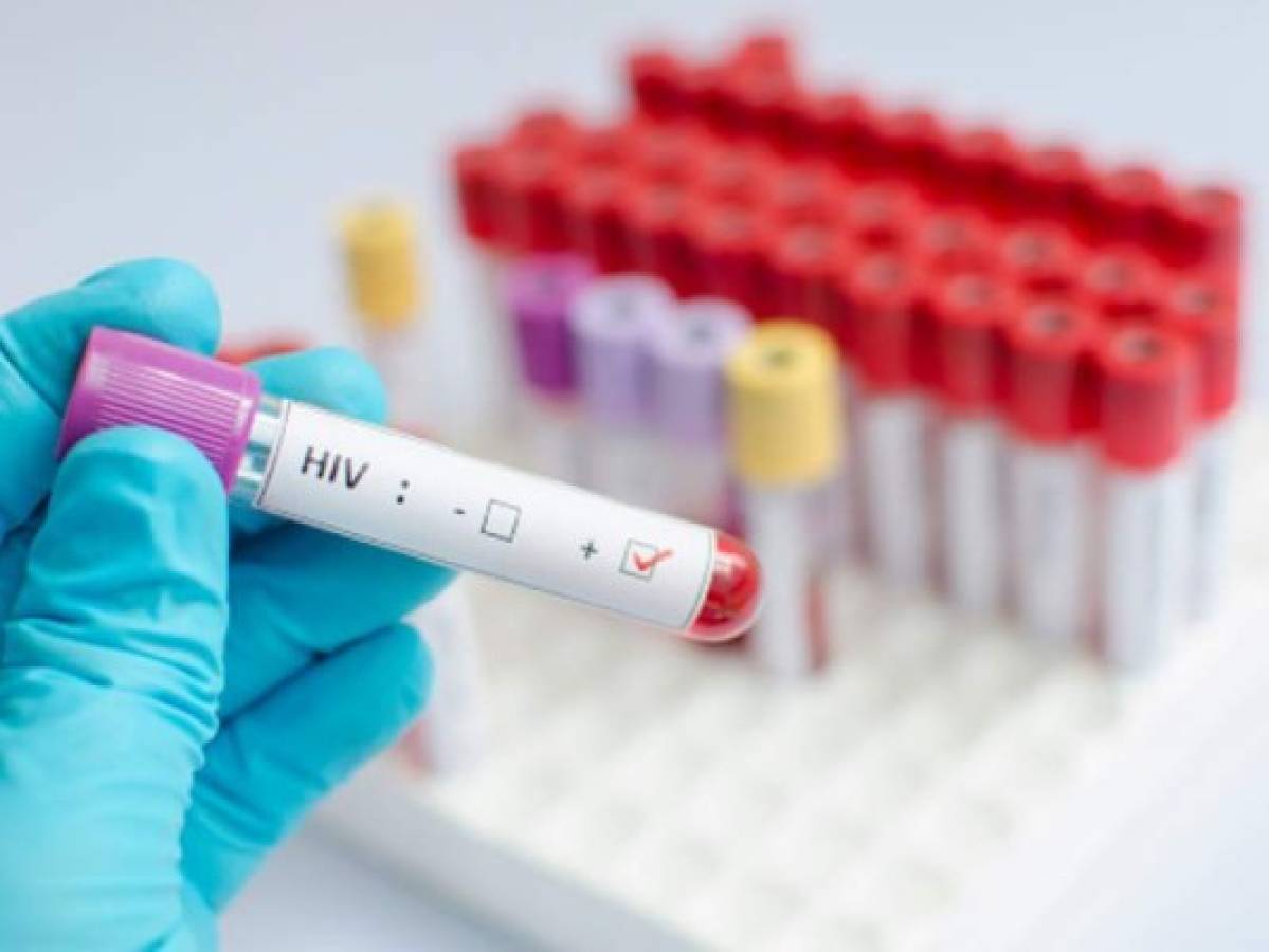 VIH significa virus de inmunodeficiencia humana, mientras que el sida se refiere al síndrome de inmunodeficiencia adquirida. El segundo es la etapa final del primero. Foto: Pixabay