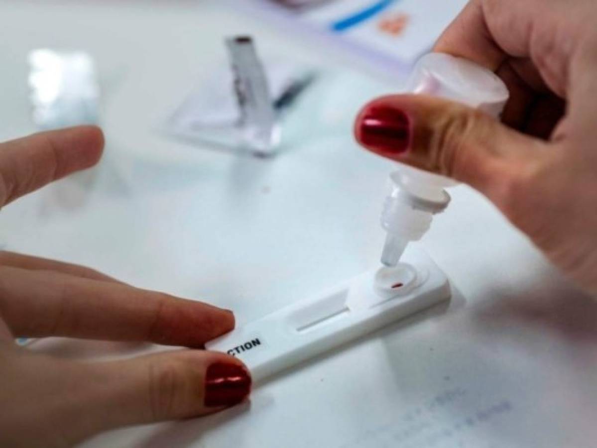 Farmacias de Brasil comienzan a vender 'auto-tests' del sida