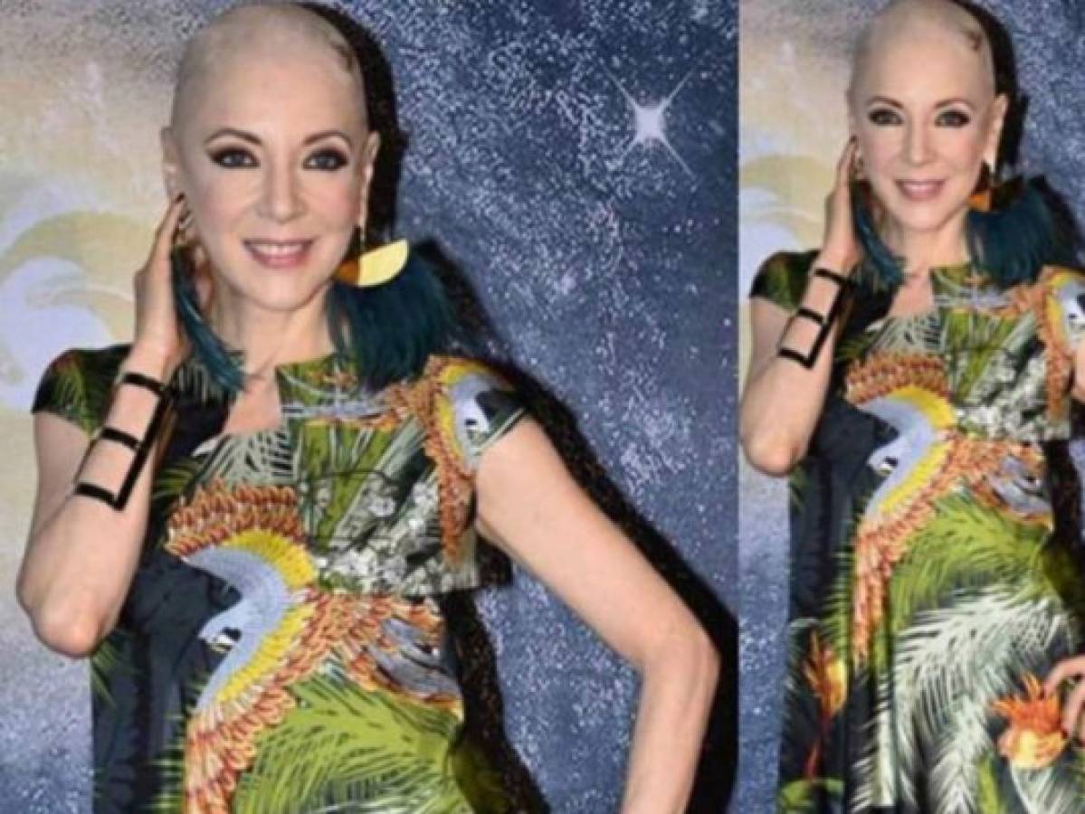Edith González recupera su cabello después de su lucha contra el cáncer de ovario