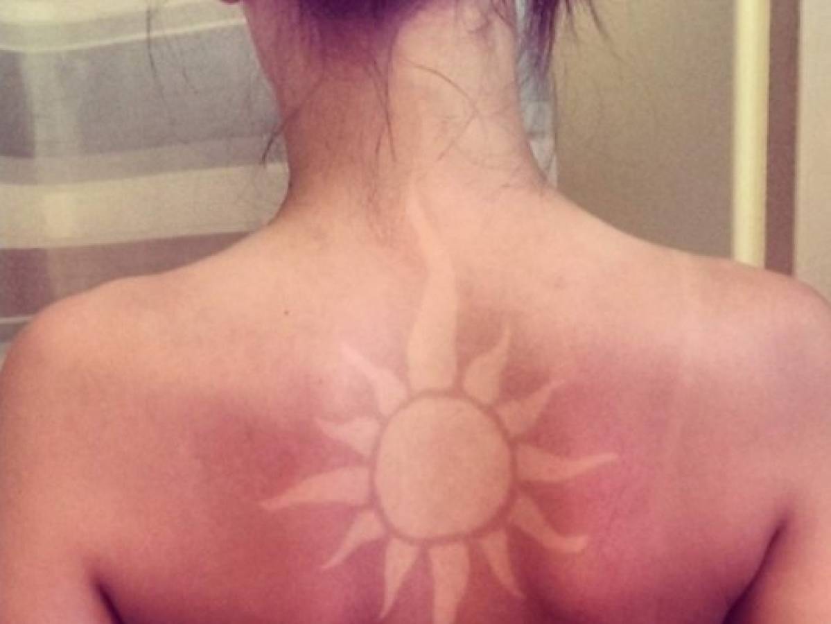 Tatuajes de Sol, la peligrosa tendencia que se apodera de las redes sociales  