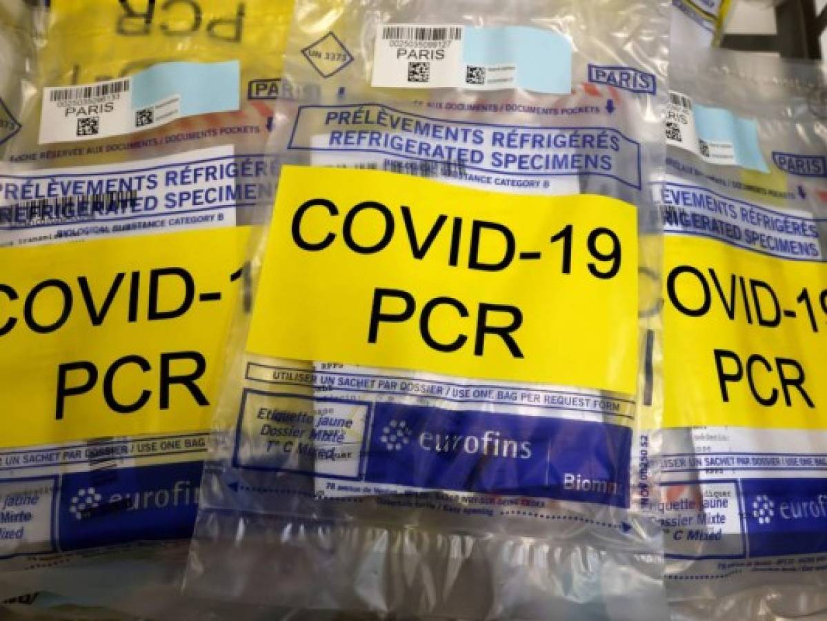 Prueba PCR: confusión de normas, guerra de precios y mercado negro
