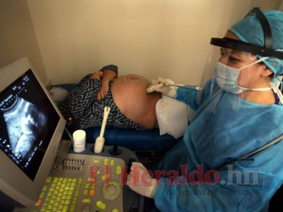 El covid-19 ha causado un centenar de muertes maternas en Honduras