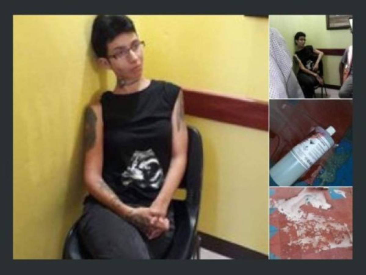 Nicaragüense rocía ácido a sacerdote mientras la confesaba