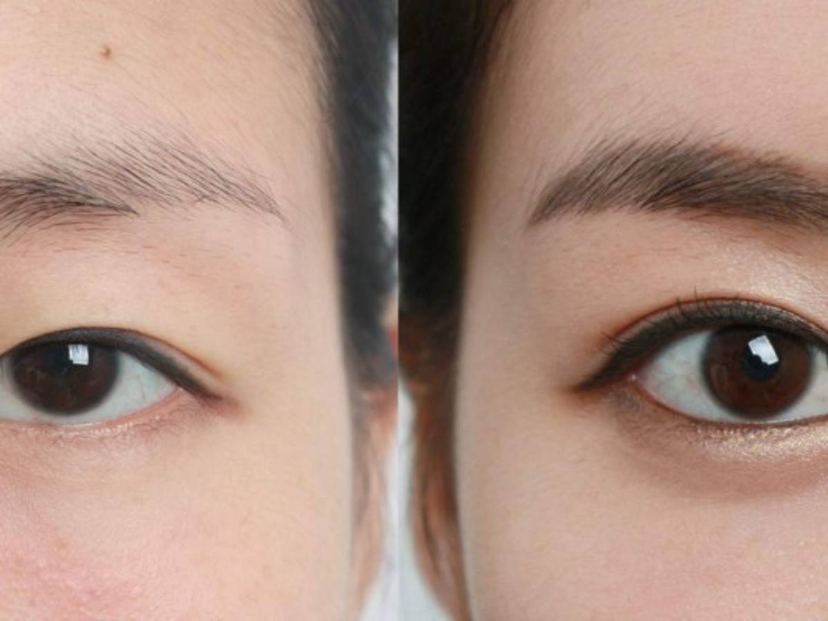 Aumentan cirugías plásticas en China para imitar belleza caucásica