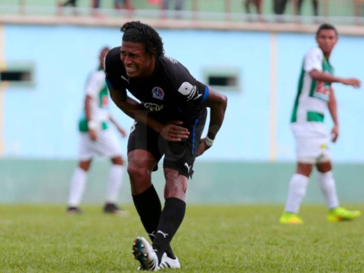 Carlo Costly salió lesionado y Olimpia perdió amistoso ante Juticalpa FC