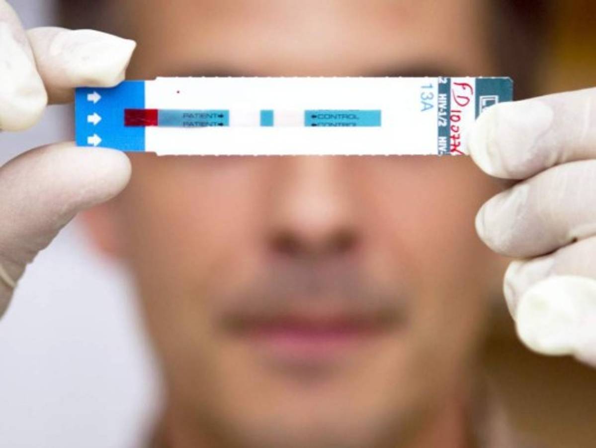 Más de 34 mil personas padecen de VIH en Honduras