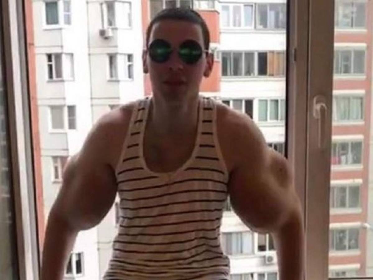 'Hulk ruso' consiguió seguidores pero a un doloroso precio