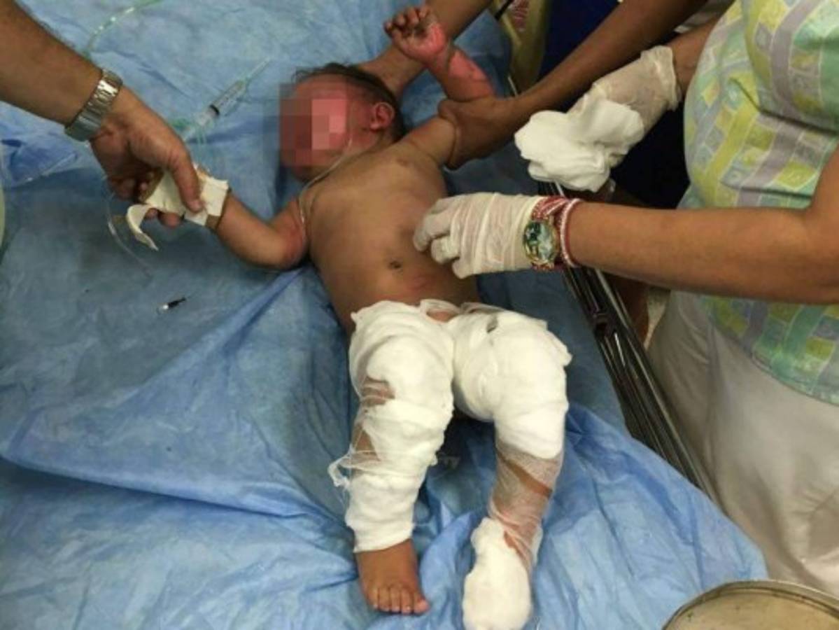 Bebé de nueve meses es rescatada de incendio en El Progreso