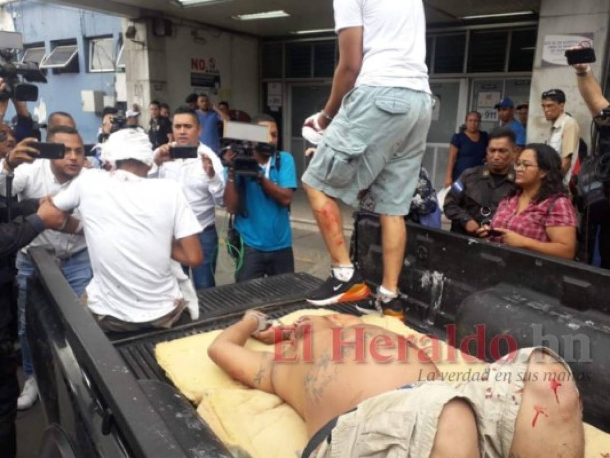 Muere uno de los seis reos heridos en motín en cárcel de El Porvenir