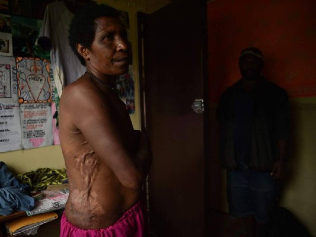 Cacería de brujas hace imperar el terror en Papúa Nueva Guinea 