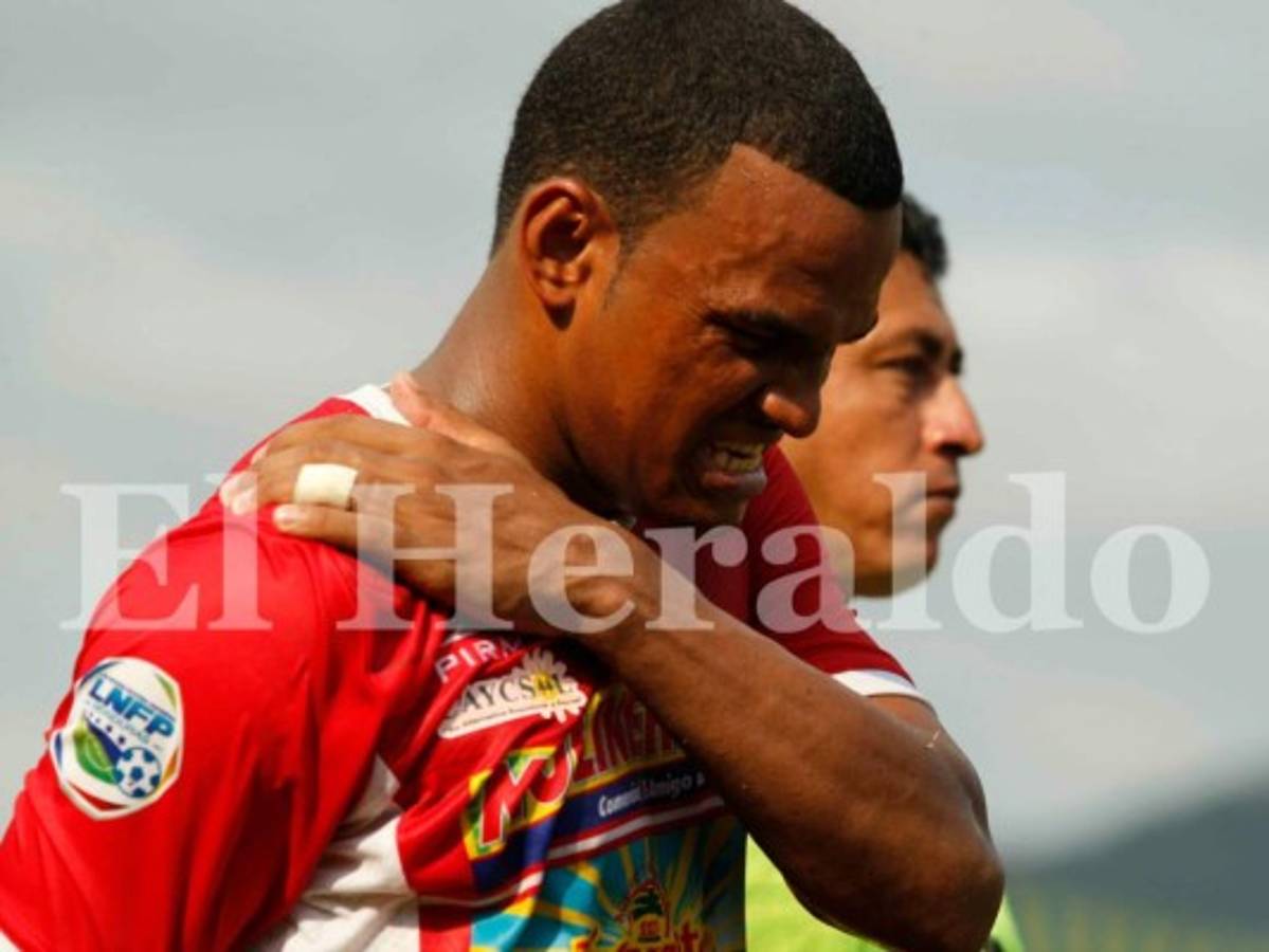 VIDEO: Brutal patada que le propina el arquero de Real España a Rony Martínez