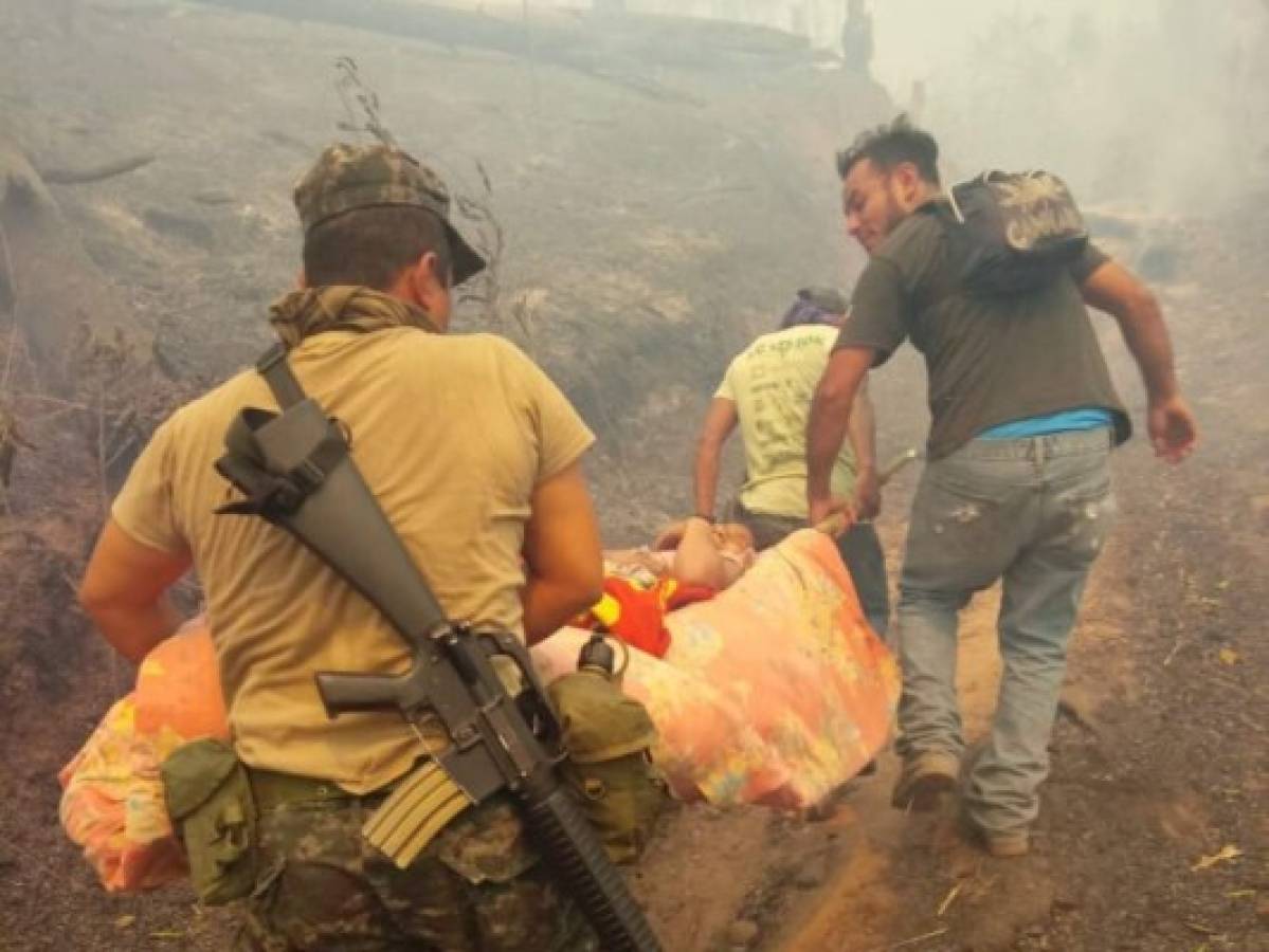 Voraz incendio forestal en Comayagua provoca severas quemaduras a tres niñas