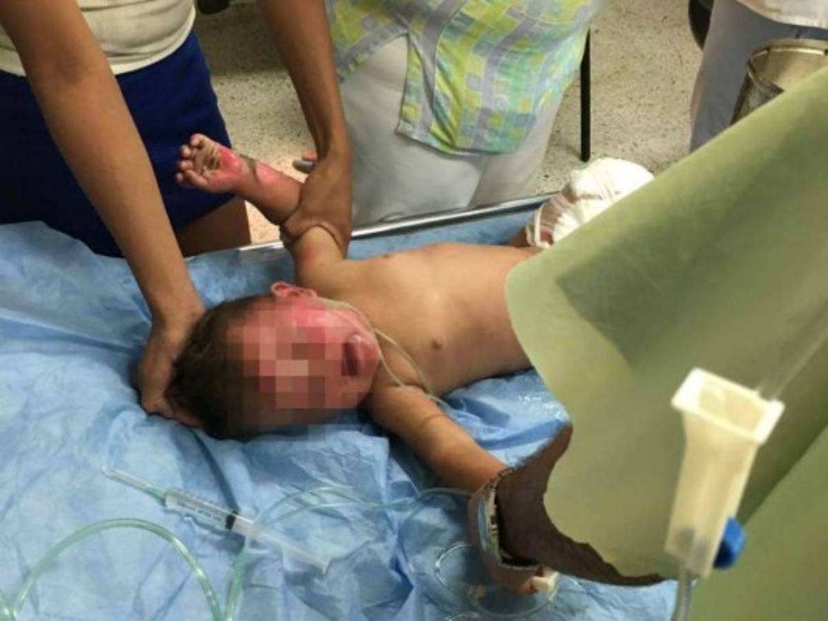 Bebé de nueve meses es rescatada de incendio en El Progreso