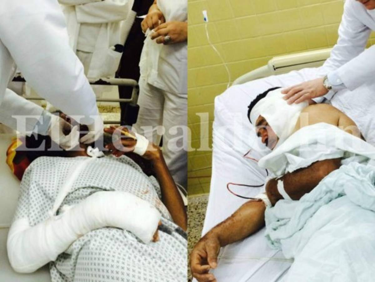 Dos personas han resultado afectadas por las lluvias que han azotado Honduras en los últimos días