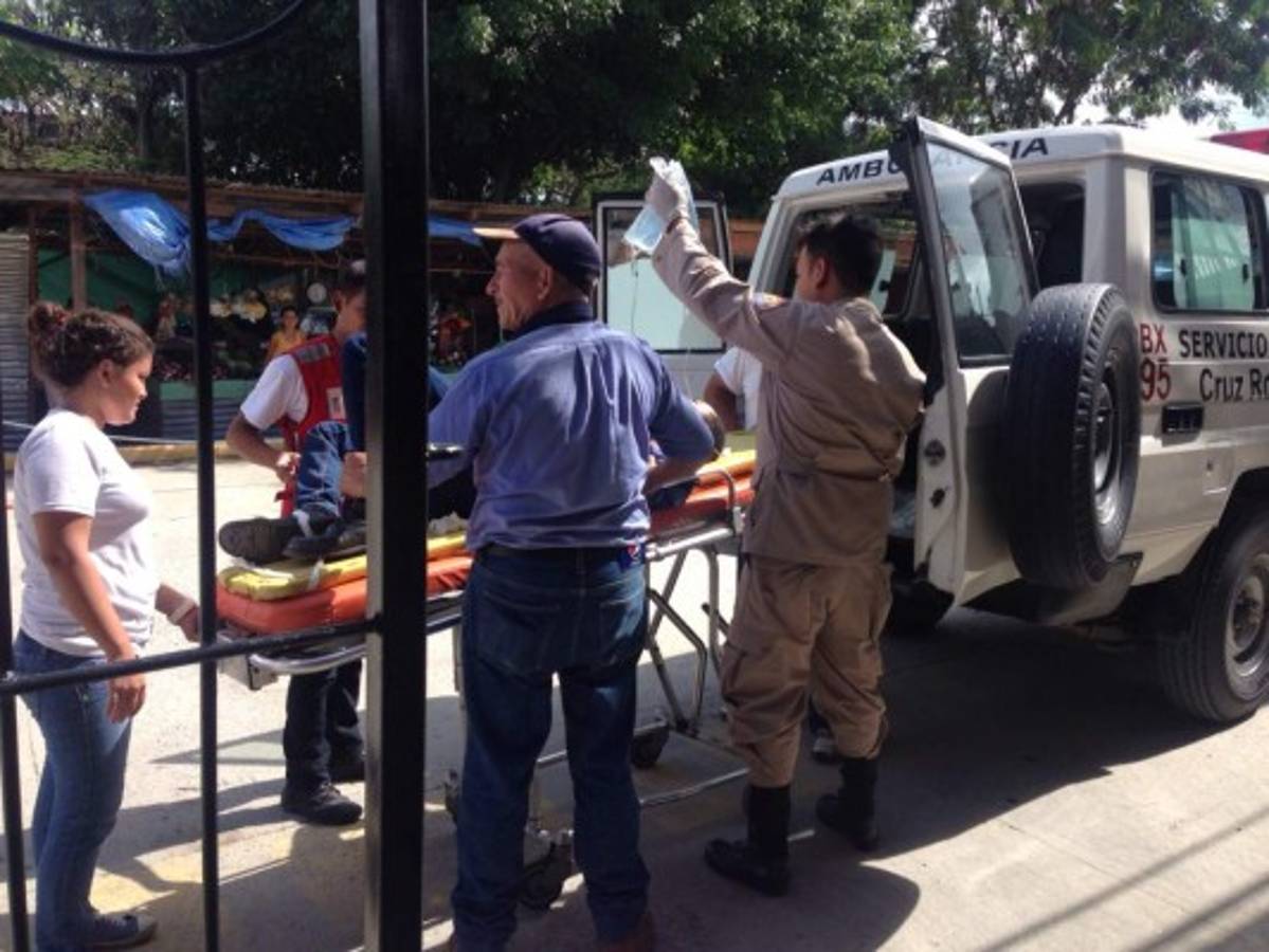 Joven resulta con graves quemaduras al rozar cables de alta tensión