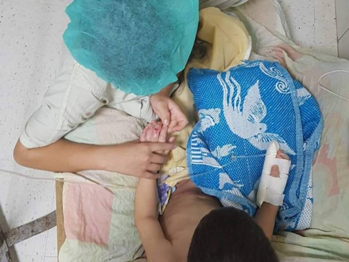 Niños que resultaron quemados en casa abarrotan salas del Materno Infantil ¿Cómo prevenirlo?