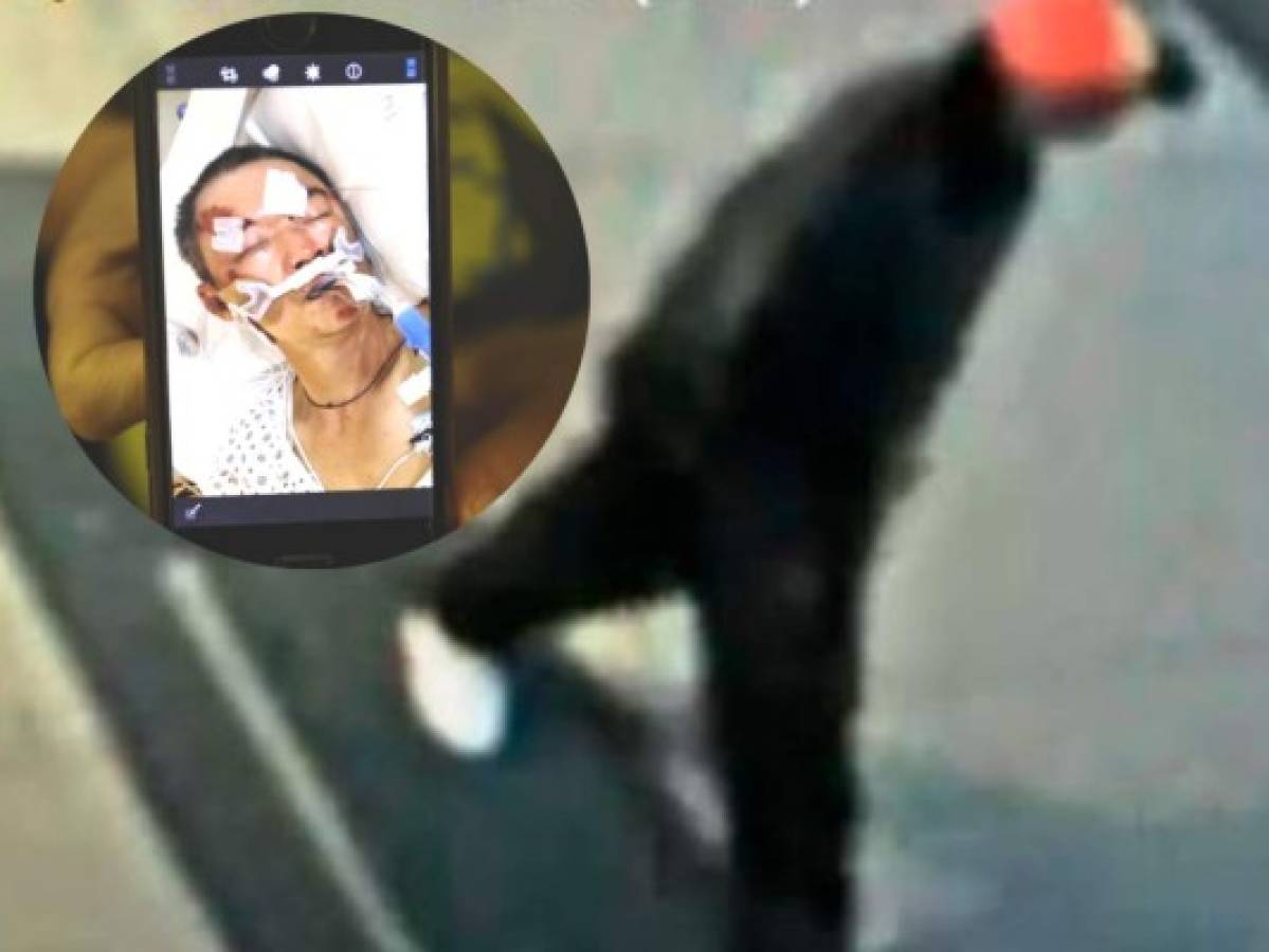Policía de Nueva York busca a hombre que golpeó brutalmente a anciano asiático