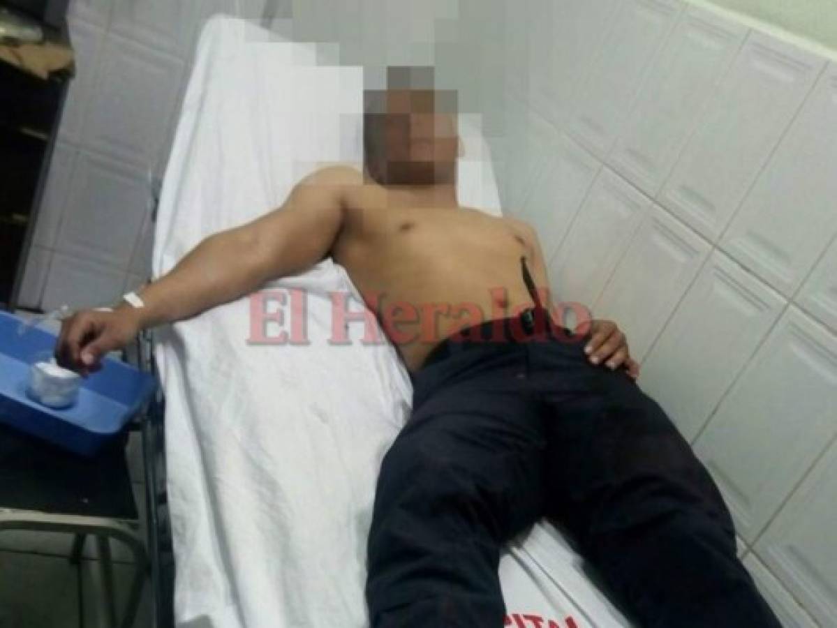 Un policía muerto y varios heridos tras emboscada de delincuentes en El Rosario, Comayagua