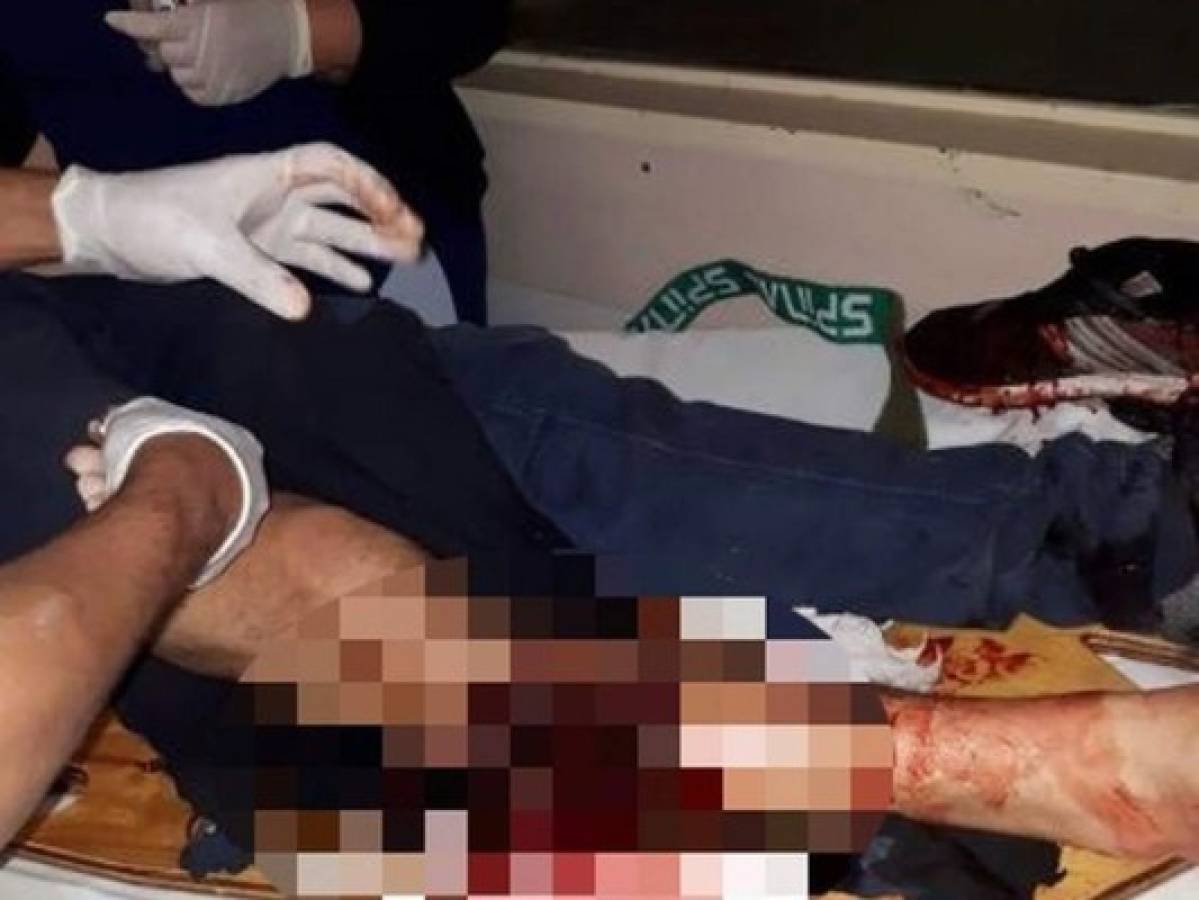 Primo de Jonatan Maidana terminó con pierna herida tras caos en Lanús