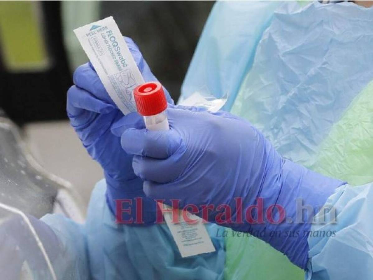 Salud a la espera de llegada de pruebas para detectar el covid-19