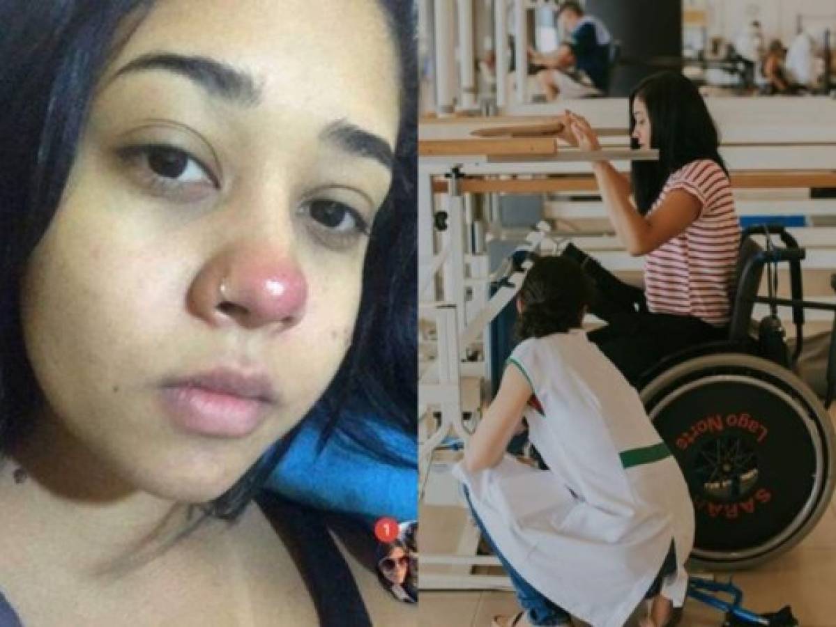 Joven se infectó tras ponerse un piercing en la nariz y perdió la movilidad en las piernas