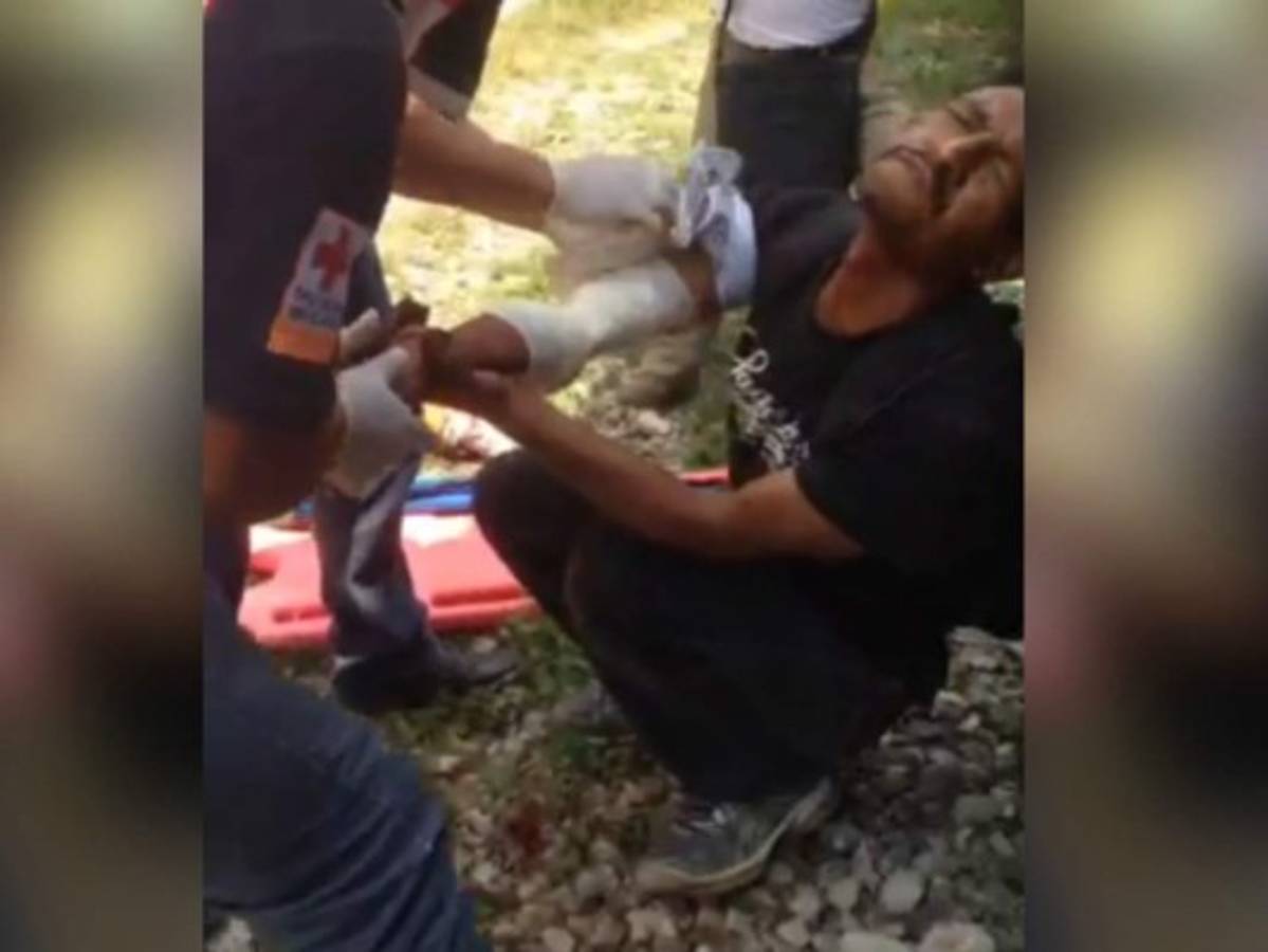 Trató de evitar caer en las vías, pero en su intento de salvarse, su brazo derecho terminó destrozado.