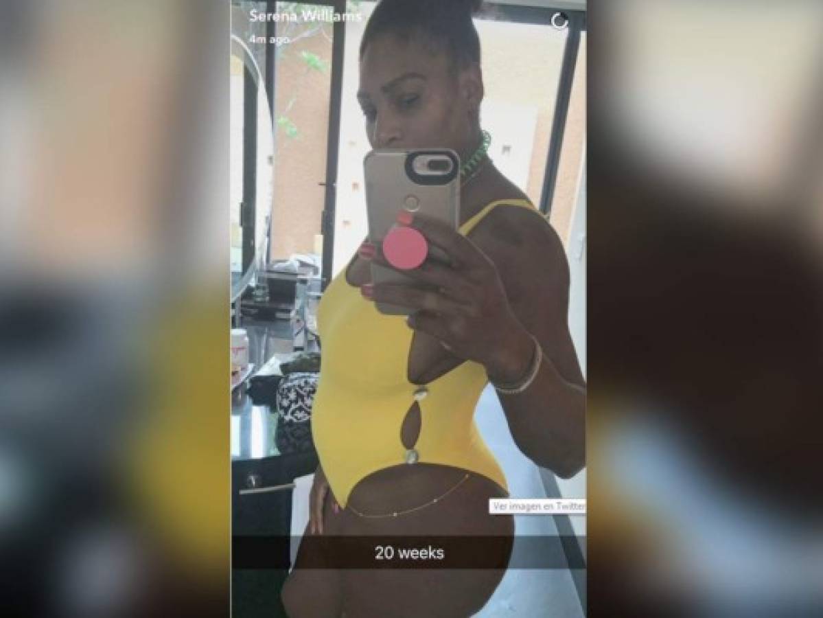 Serena Williams está embarazada