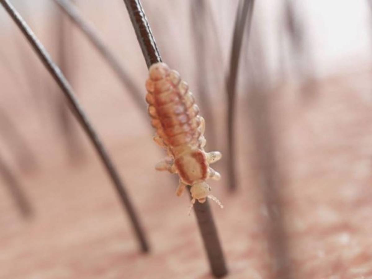 Los piojos en los seres humanos es otra de las patologías más usuales en este tipo de hacinamientos ya que las condiciones higiénicas no son las mejores y se transmiten de manera fácil.