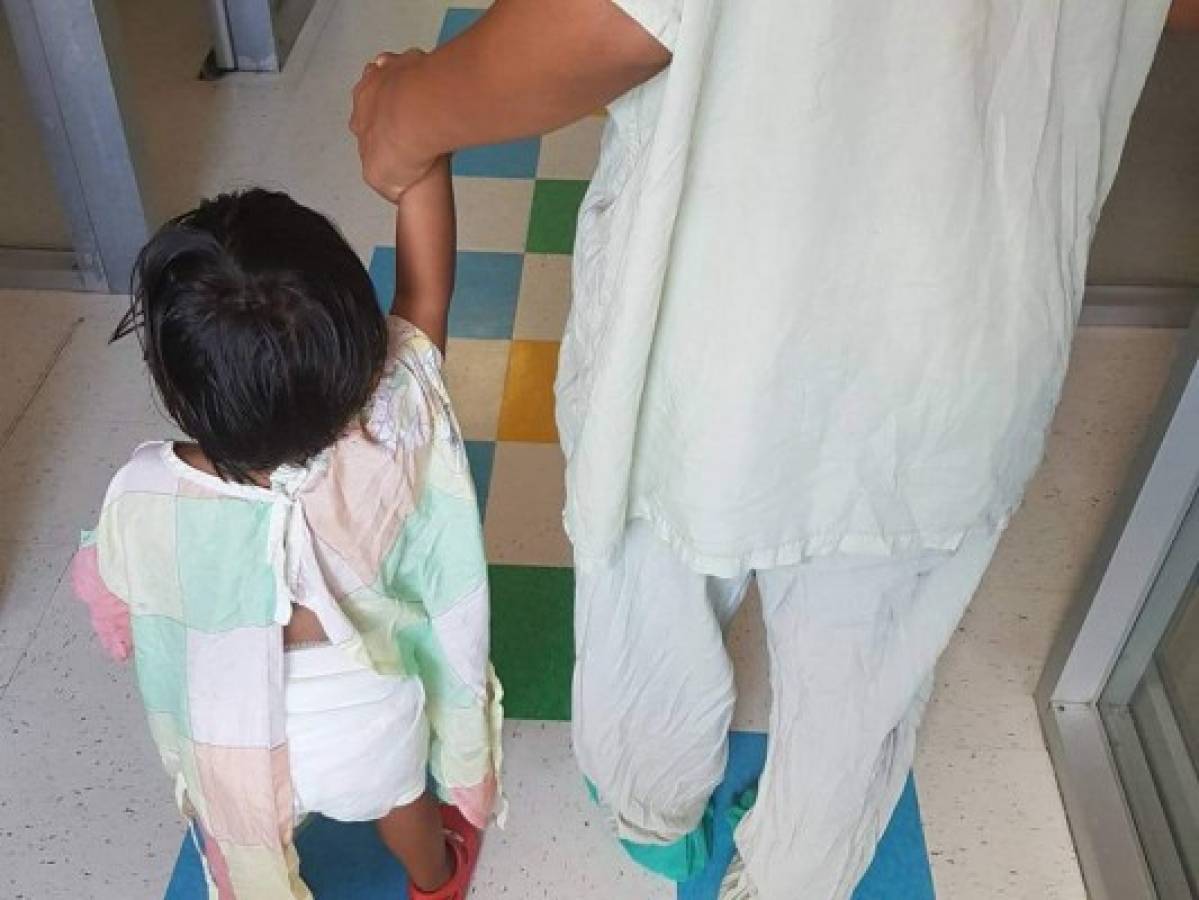 Niños que resultaron quemados en casa abarrotan salas del Materno Infantil ¿Cómo prevenirlo?