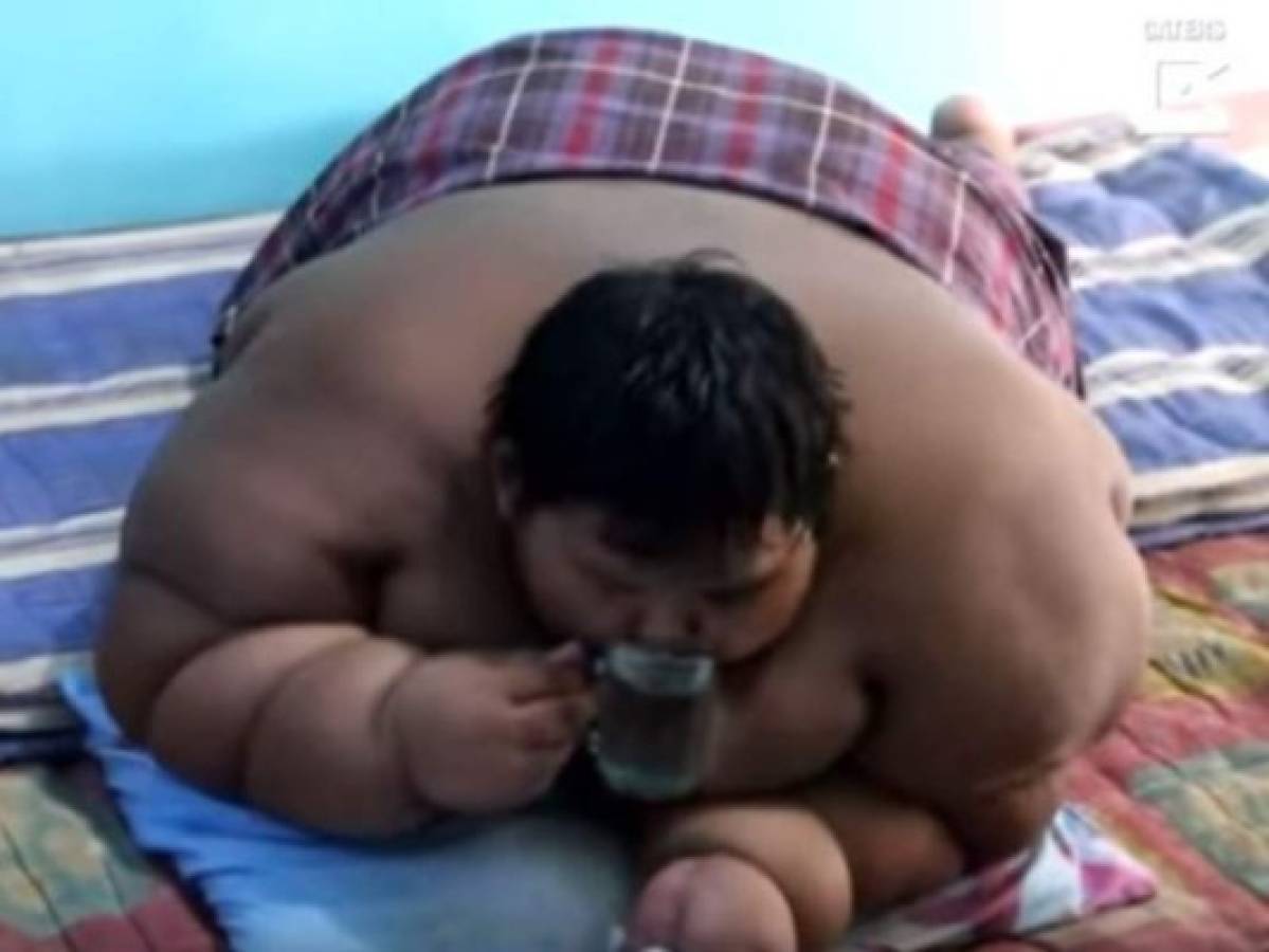 VÍDEO: El niño 'más gordo del mundo' luce radical cambio tras haber bajado 220 libras