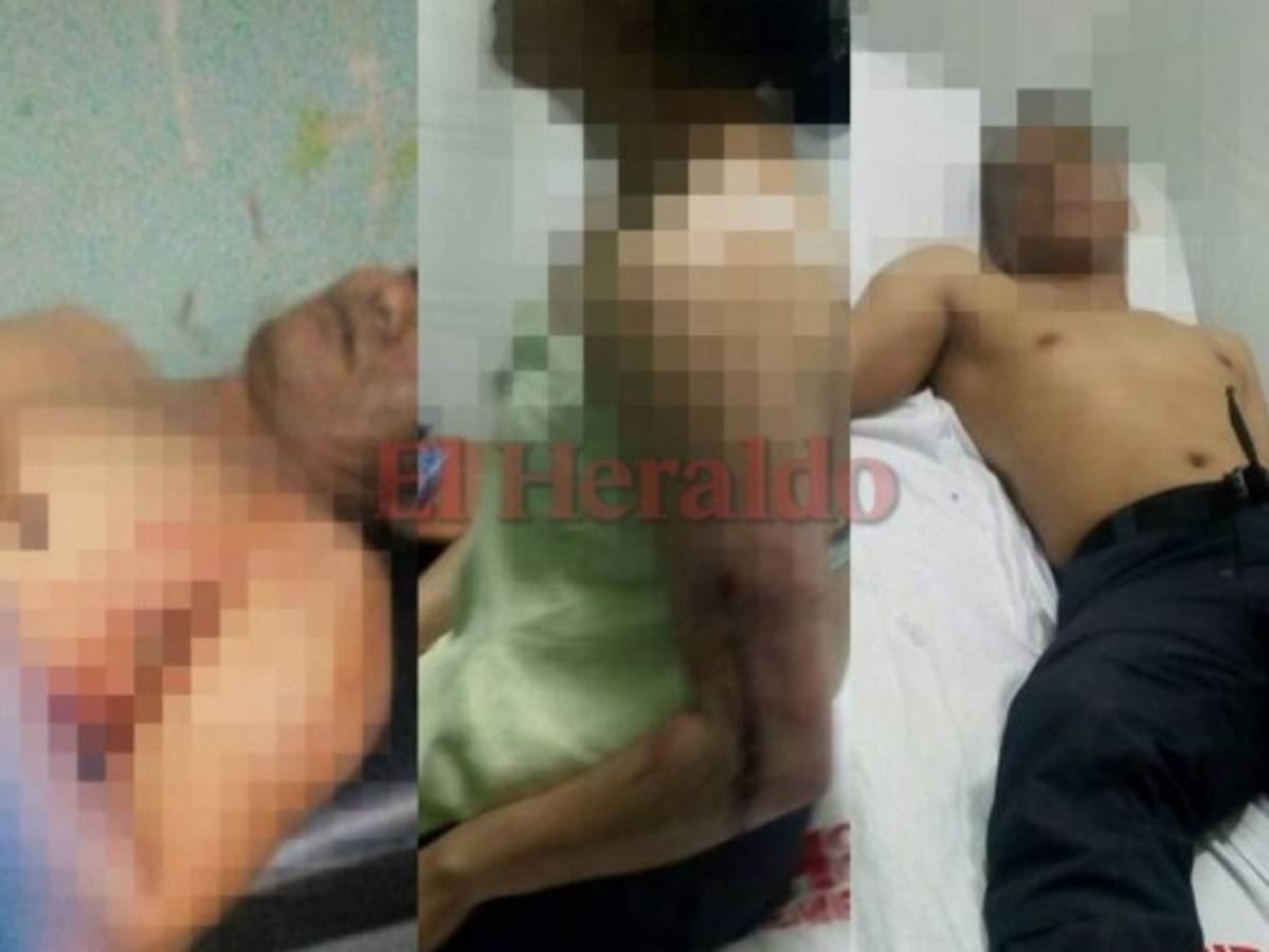 Un policía muerto y varios heridos tras emboscada de delincuentes en El Rosario, Comayagua