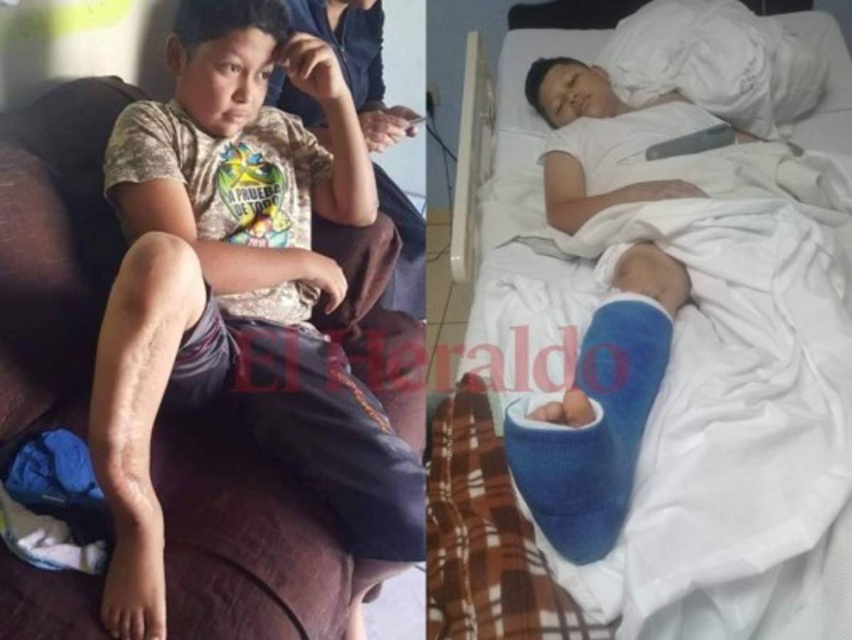 Solidaridad de los hondureños logra operación de Aleck Joan Flores