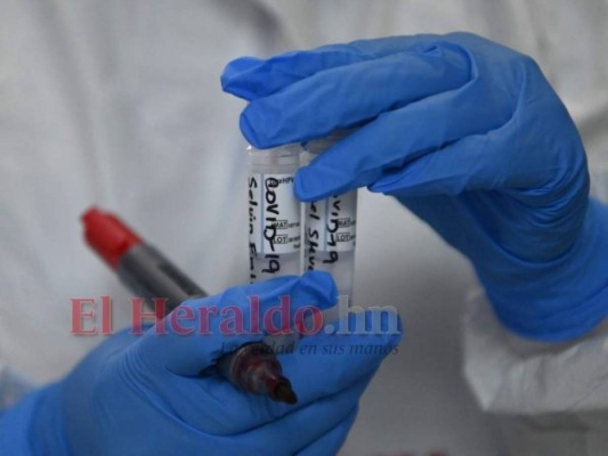 Secretaría de Salud confirma cambio de las pruebas PCR por antígeno