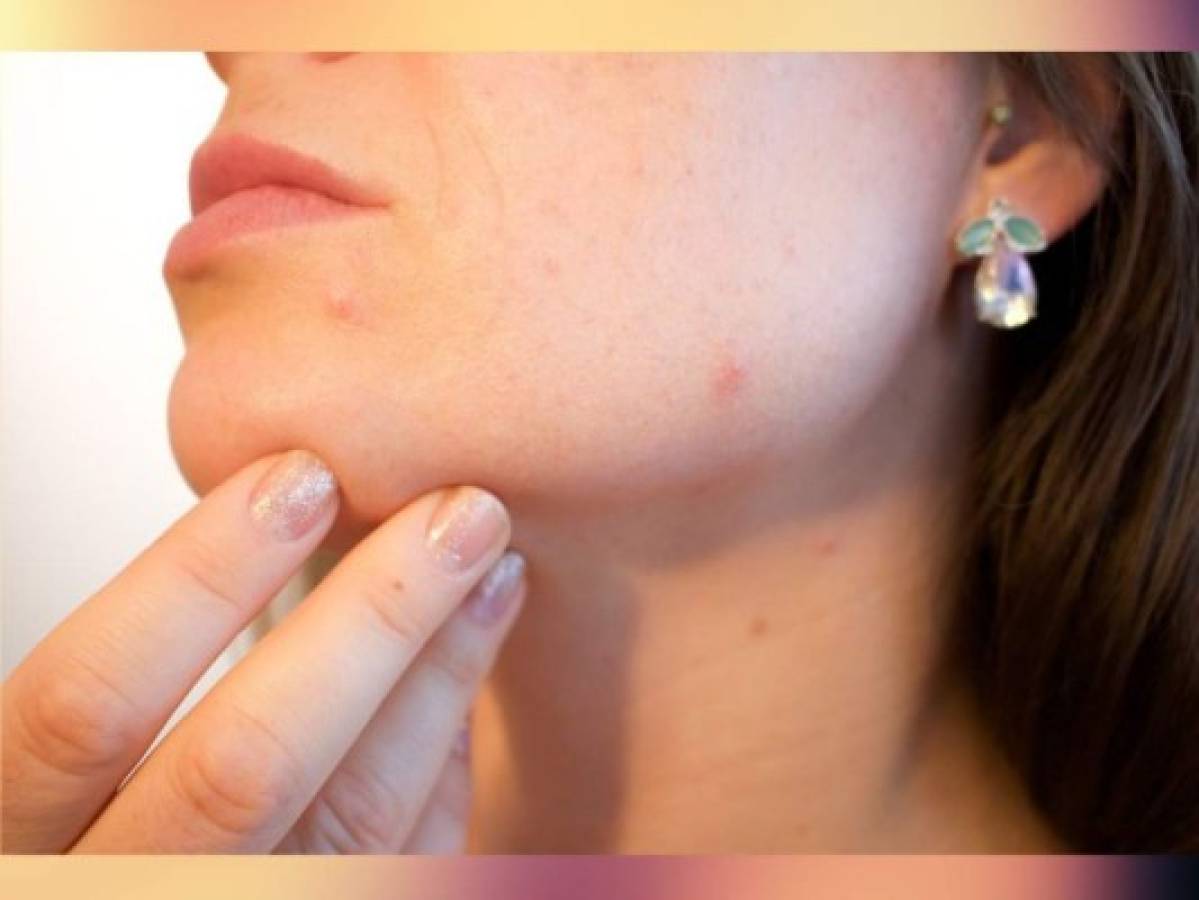 Cinco consejos para rejuvenecer el rostro y evitar arrugas