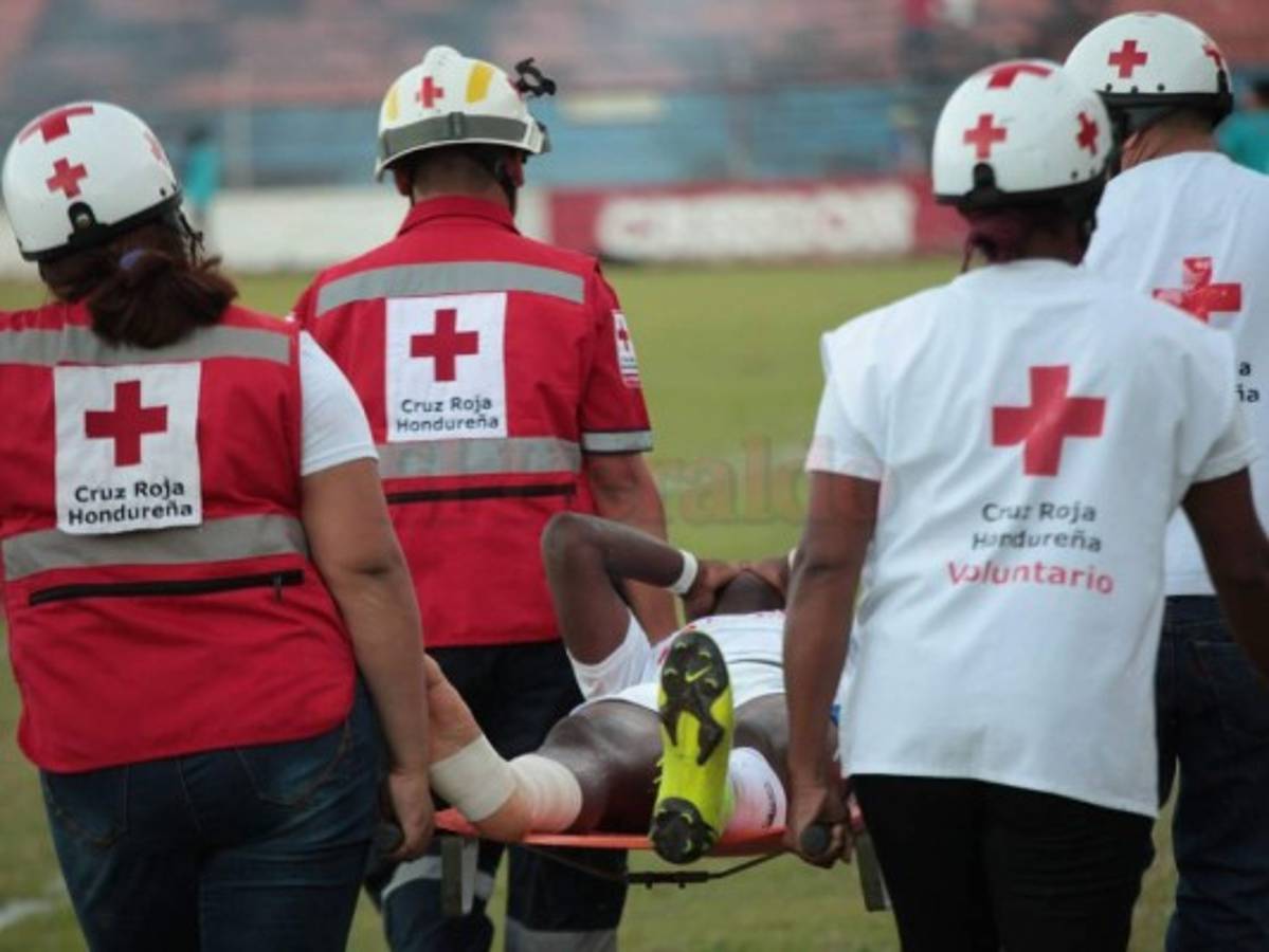 Olimpia: John Paul Suazo estará de baja tres meses por fractura en la tibia  