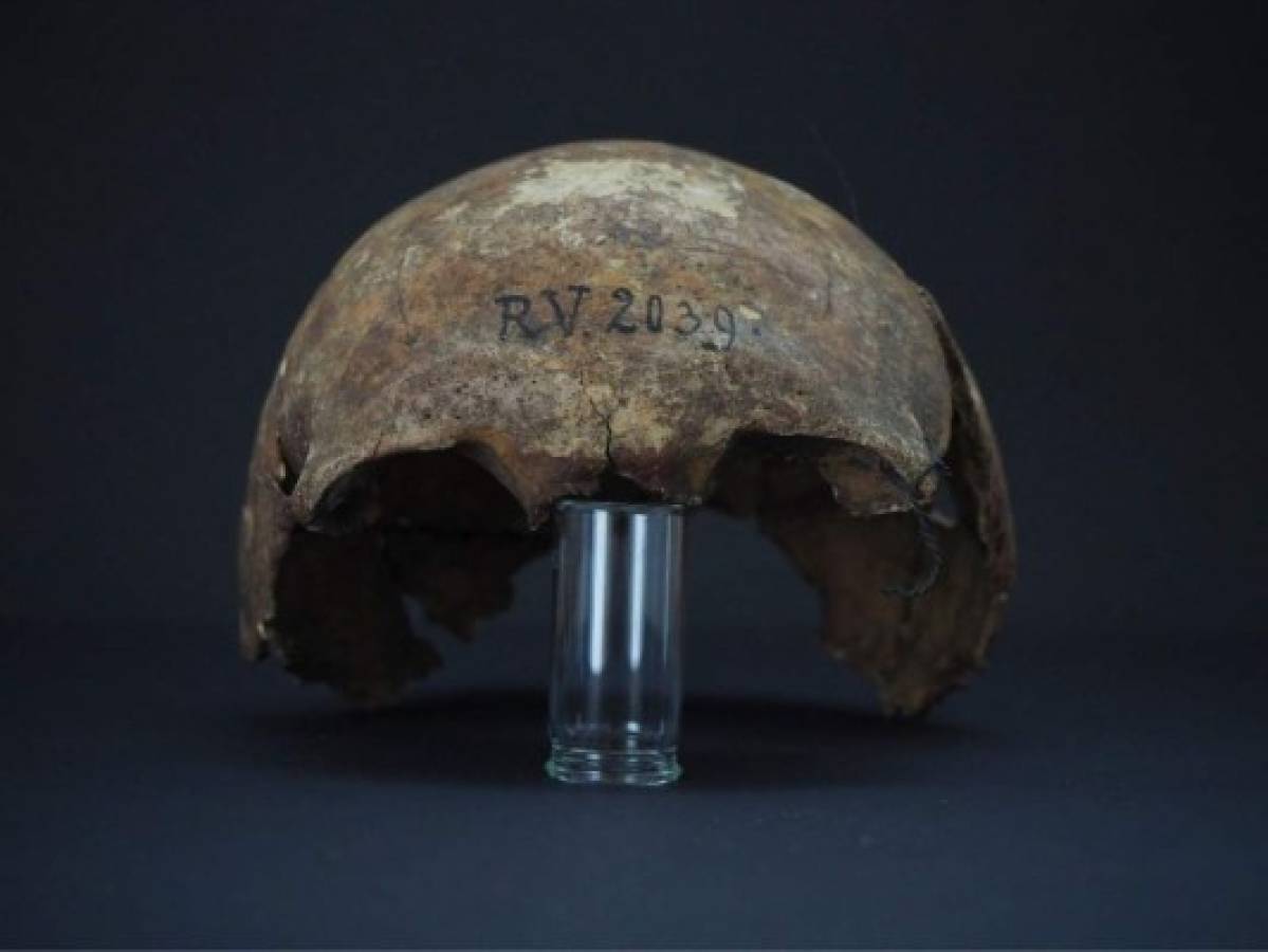 Identifican a hombre de hace 5,000 años como primera víctima de peste negra  