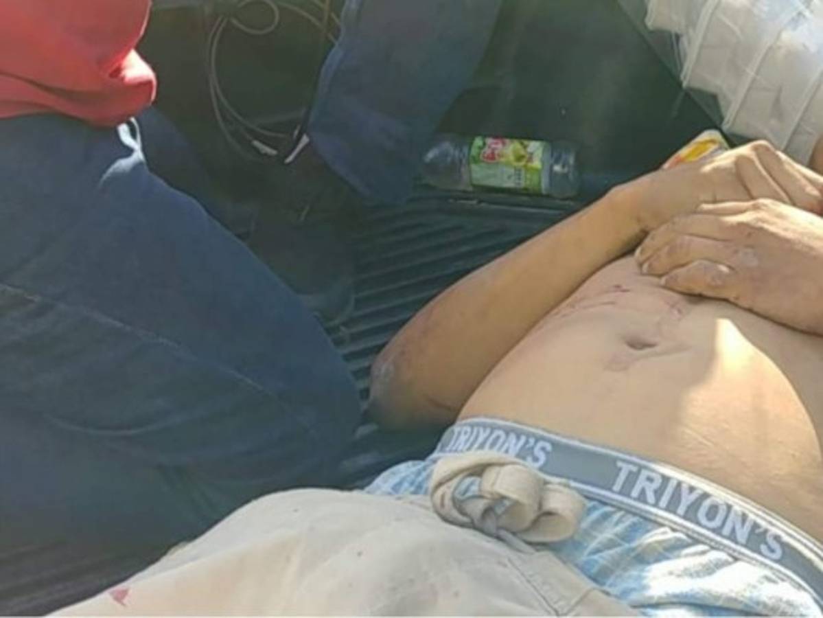 Matan a hombre que supuestamente asaltaba un rapidito en Comayagüela